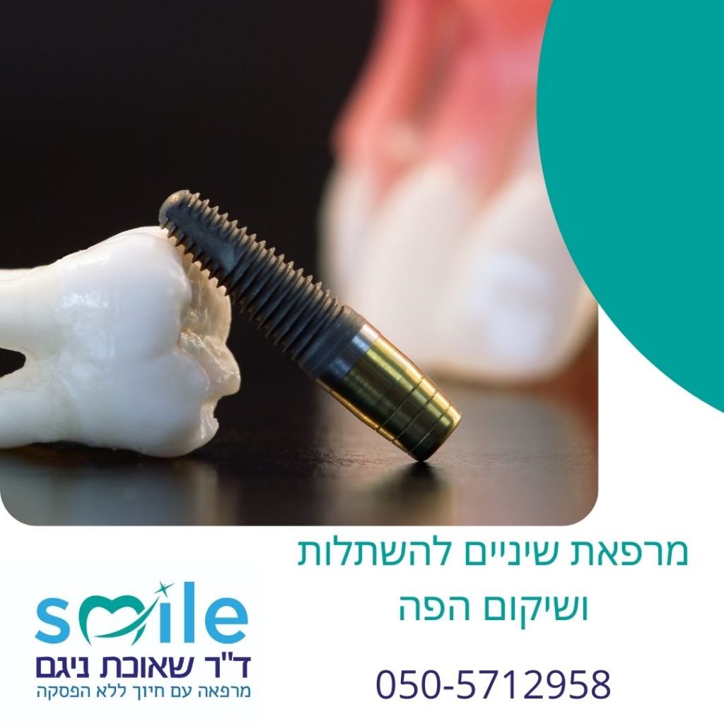 מרפאת שיניים להשתלות ושיקום הפה