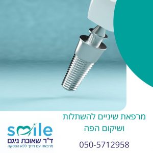  השתלת שיניים – סיבות וטיפולים