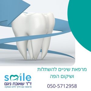 שימור שיניים-הלבנת שיניים מומלצת בזכרון 