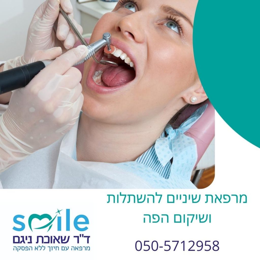 ניתוחי חניכיים- טיפולי שיניים בזכרון יעקב