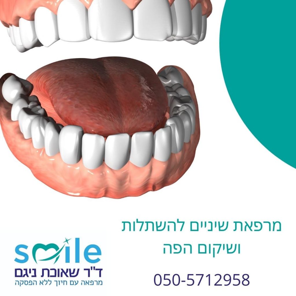 החלפת שיניים חסרות- השתלת שיניים ביום אחד